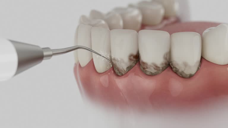 Trusted Emergency Dentist service in Ann Arbor, MI - Dentist Open Now